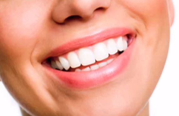 DIY whitening