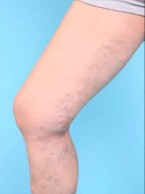 Veins